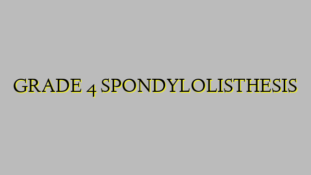 GRADE 4 SPONDYLOLISTHESIS